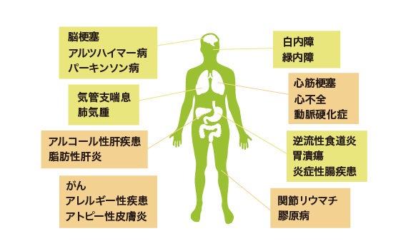 論文『なぜ抗酸化配合剤Twendee X®︎は認知症を予防することができるのか？』がInternational Journal of Molecular Sciencesに掲載されました