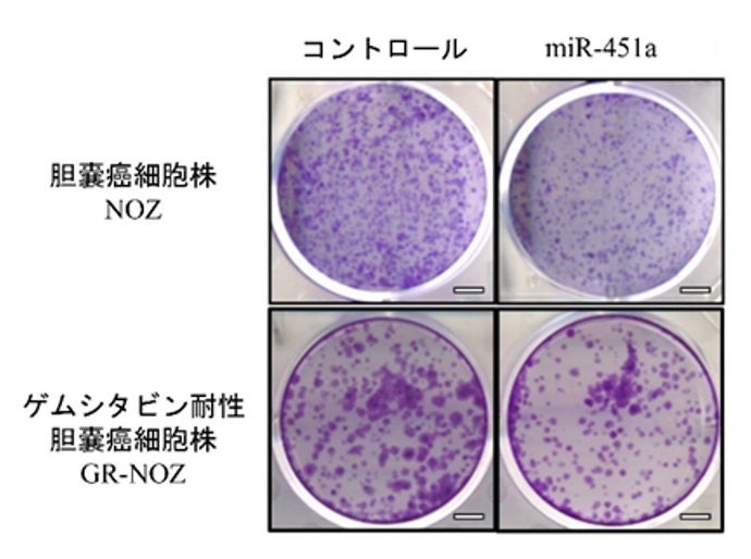 コントロールに比べて、miR-451aを導入した細胞株では細胞の集団（紫色の塊）の数が減少している