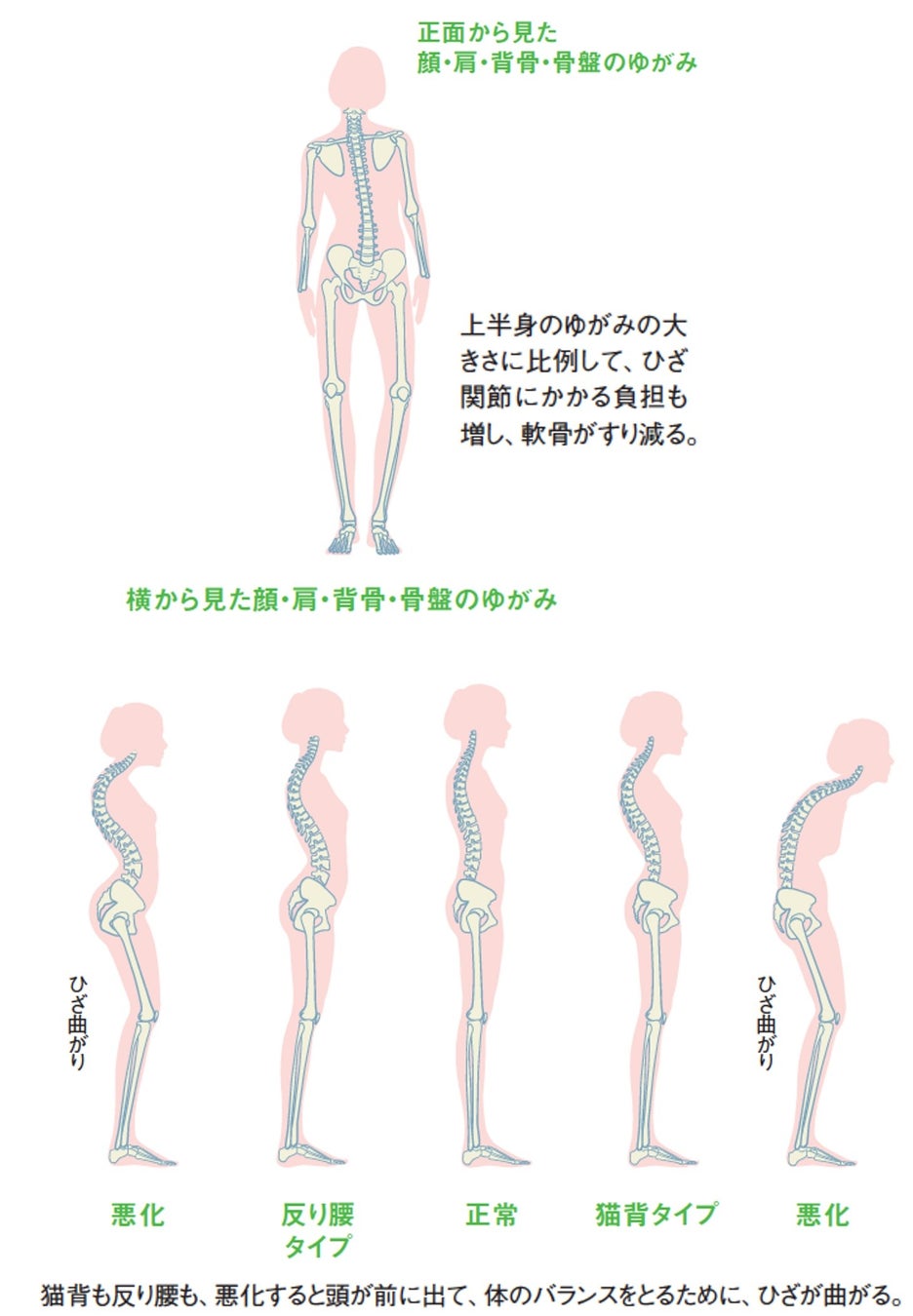 世界初！精度高く姿勢を整えることで、ひざ痛を解消するメソッドが健康誌『わかさ』に掲載された感謝キャンペ...