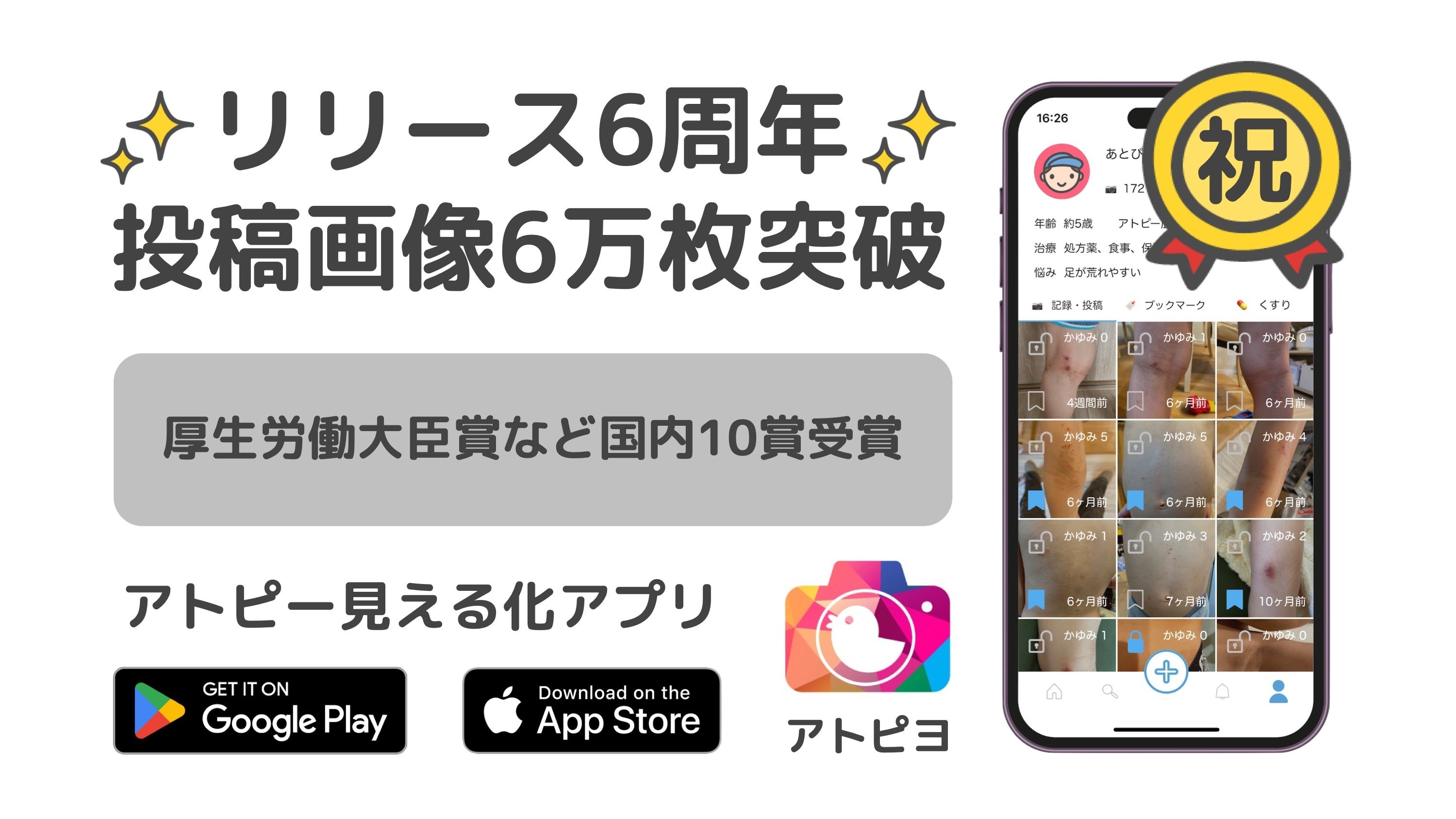 日本最大級のアトピー患者向けアプリ「アトピヨ」が6周年を迎え、投稿画像は6万枚突破！ 〜リリース6年で、厚...