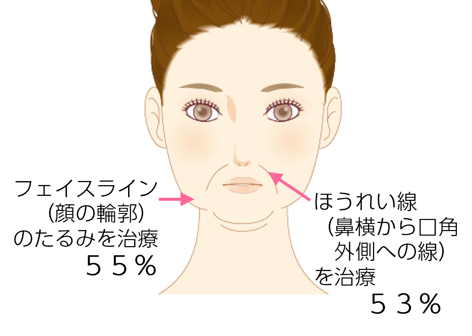 たるみ治療、何をした？効果はあった？意外!? 満足度1位は “ボトックス” 。７４％が「受けてよかった」