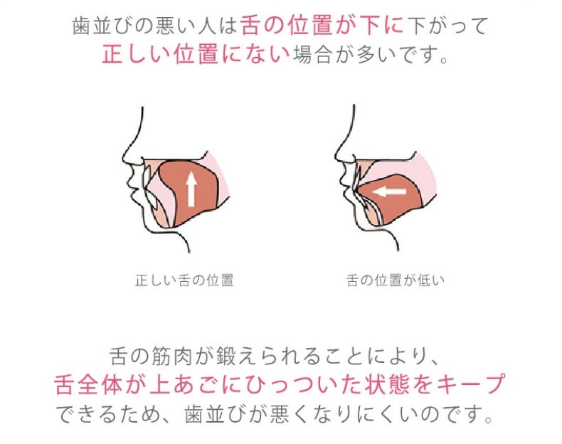 きれいな歯並びは乳幼児期から！お口発達スタートキット普及プロジェクトをキャンプファイヤーにて開始！