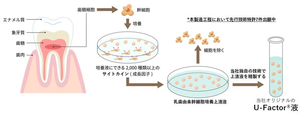 U-Factor®液による治療薬開発を目指す株式会社U-Factorが東京慈恵会医科大学と共同研究契約を締結