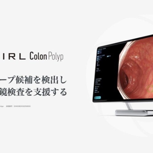 大腸内視鏡診断支援AI「EIRL Colon Polyp」が診療報酬の加算対象に