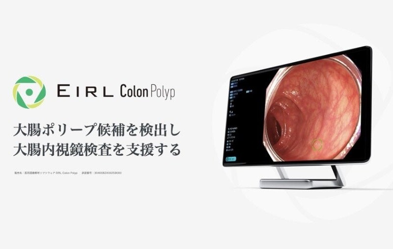 大腸内視鏡診断支援AI「EIRL Colon Polyp」が診療報酬の加算対象に