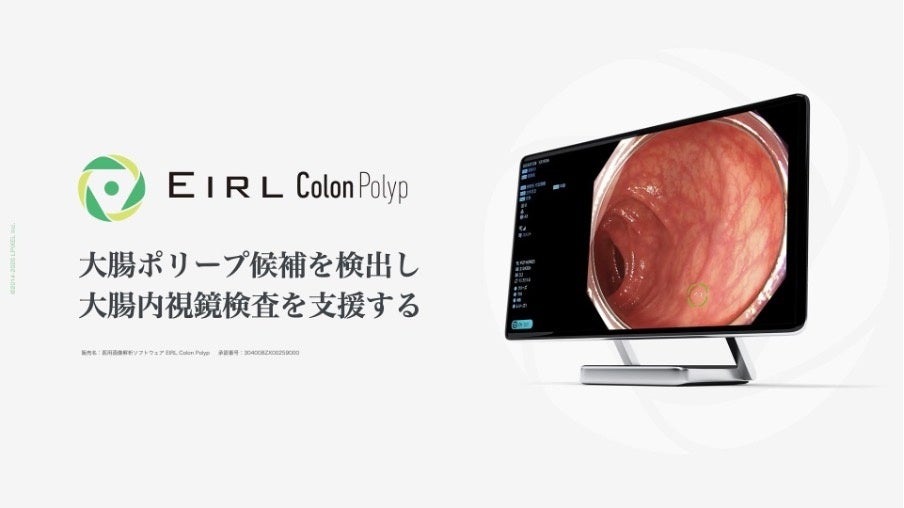 大腸内視鏡診断支援AI「EIRL Colon Polyp」が診療報酬の加算対象に