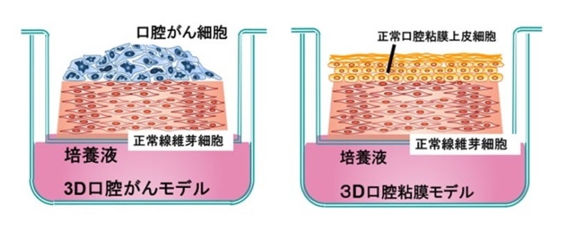 3D⼝腔がんモデルと3D⼝腔粘膜モデルの模式図