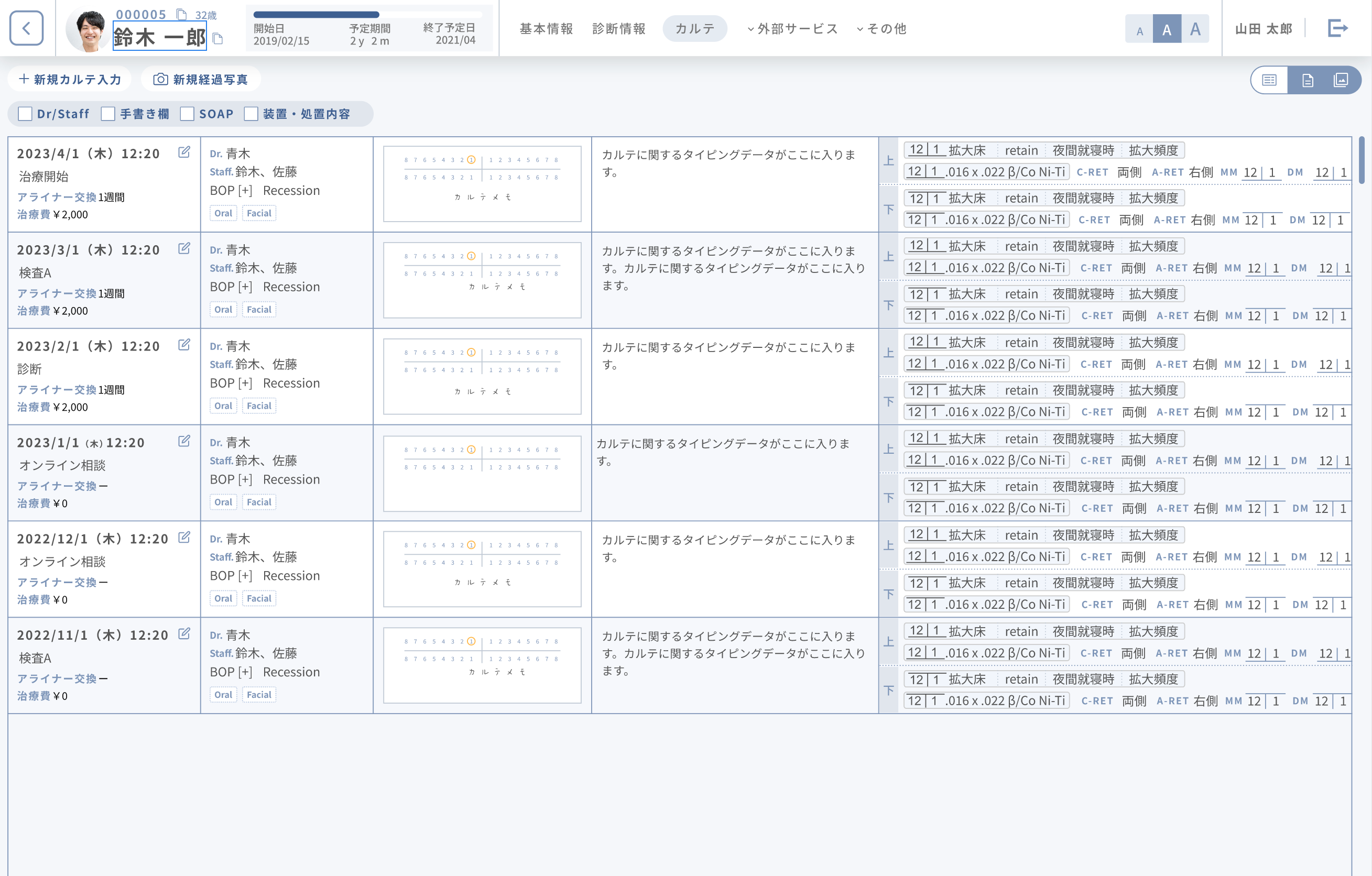 矯正歯科専門オンラインカルテ「b-align」（ビーアライン）矯正歯科技工最大手アソインターナショナルへの技...