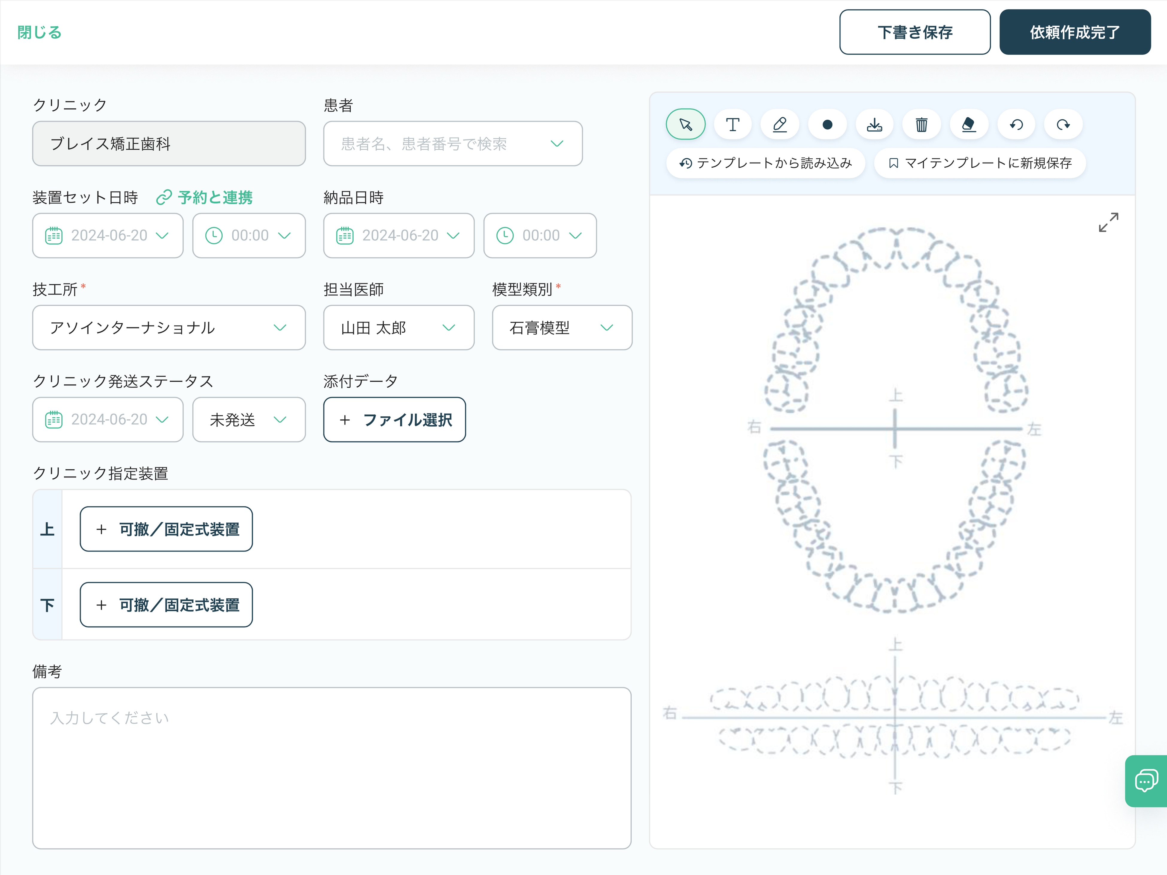 矯正歯科専門オンラインカルテ「b-align」（ビーアライン）矯正歯科技工最大手アソインターナショナルへの技...